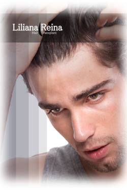 Imagen de hombre acomodandose el pelo