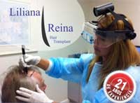 Doctora Reina realizando un trasplante pelo